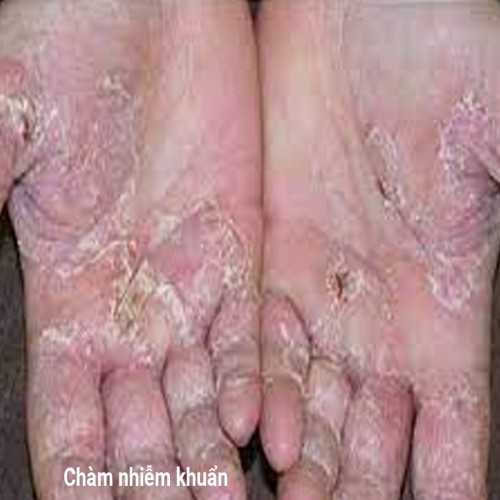 Pesancort Cream 15g